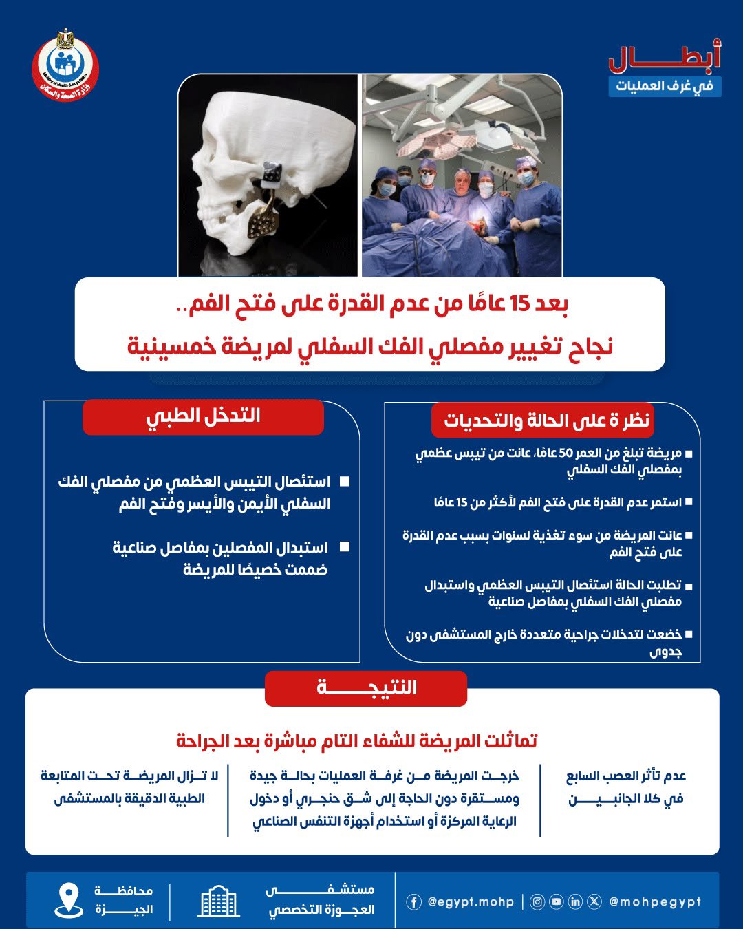 نجاح جراحة دقيقة لتغيير مفصلي الفك لمريضة عانت 15 عامًا من عدم القدرة على فتح فمها