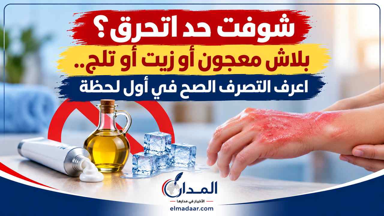 شوفت حد اتحرق؟  بلاش معجون أو زيت أو تلج.. اعرف التصرف الصح في أول لحظة